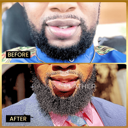 Beard Growth Magic (Beard Growth Oil)