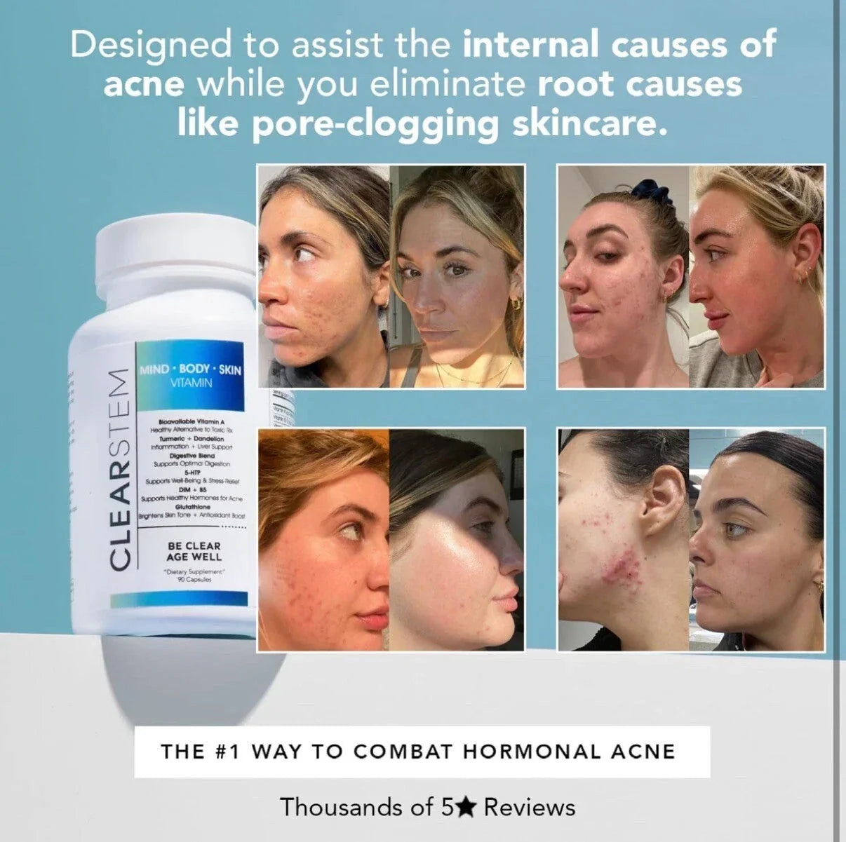 Clearstem (age+acne) MIND-BODY-SKIN Vitamin 90 Capsules